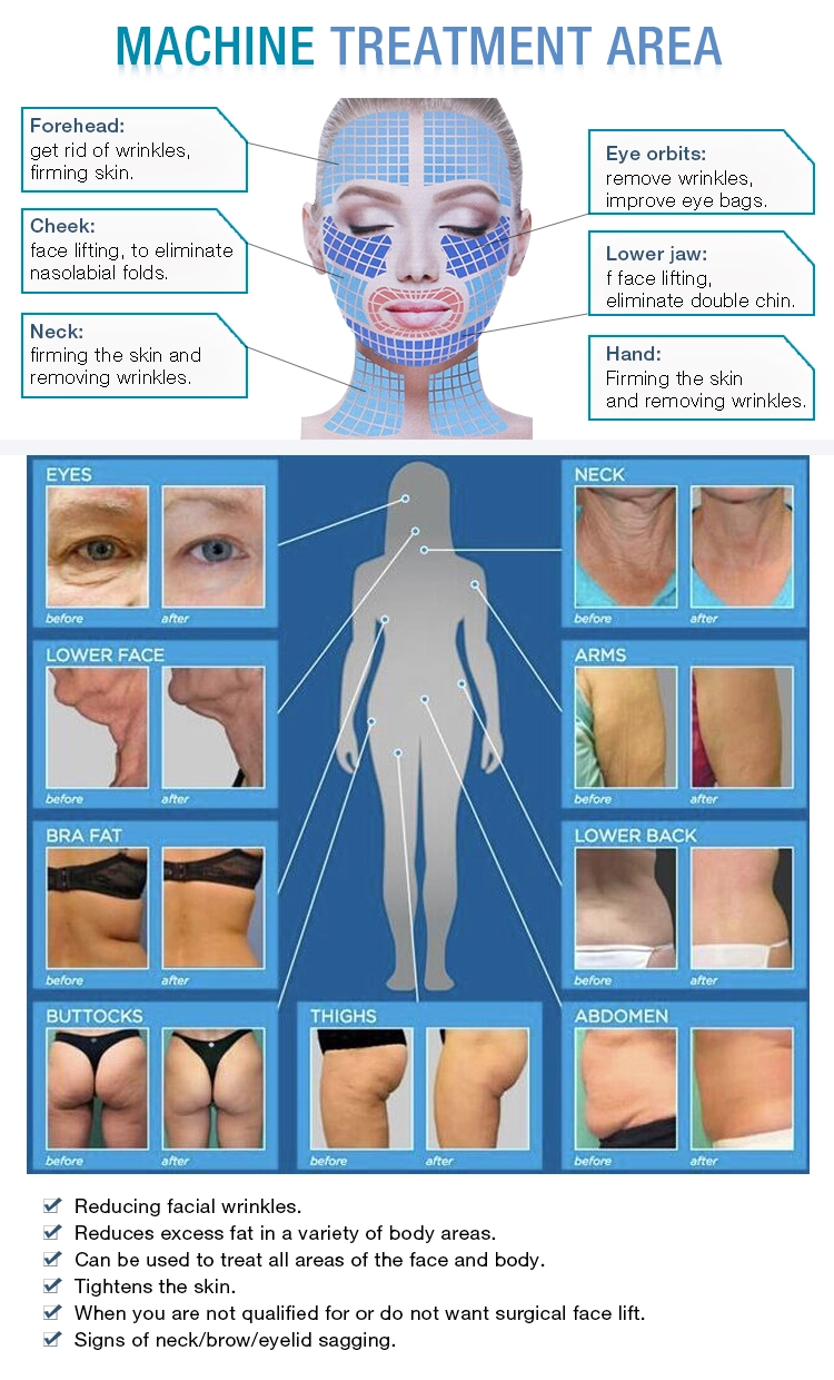 360 Anti Aging Fat Cellulitis Slimming and Weight Loss Machine